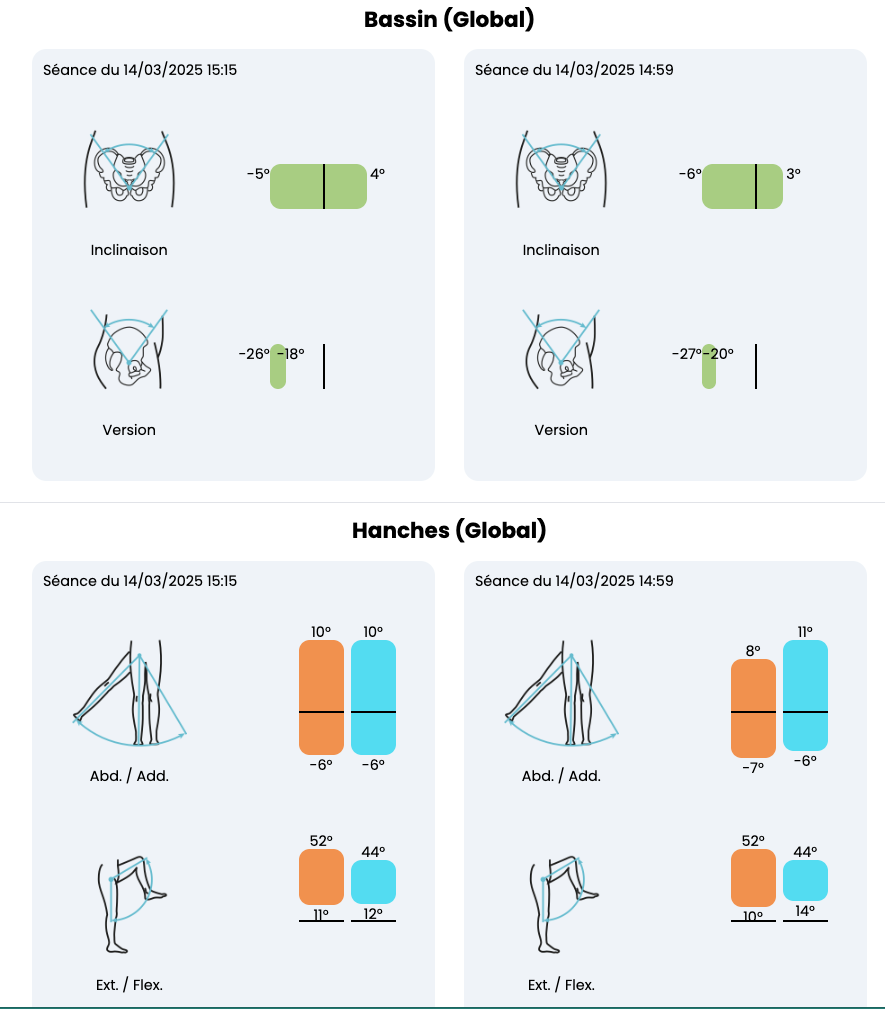 Comparaison avant après